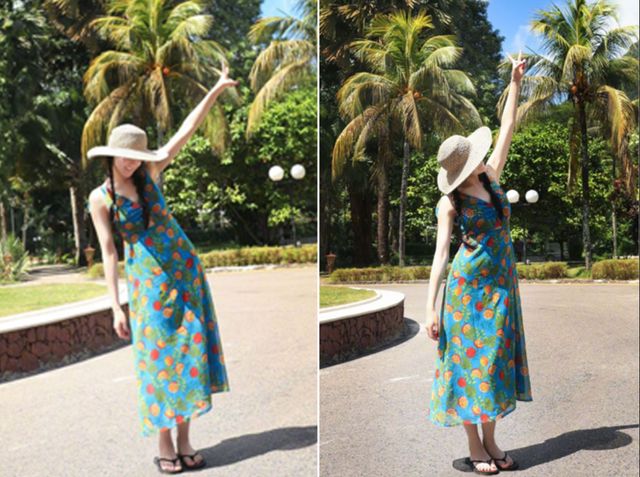 腋下不干净有干皮,腋下不干净会导致狐臭吗