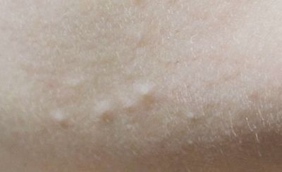 颜悦课堂的真实故事,颜悦课堂洗脸可以祛痘吗