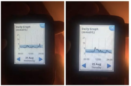 餐前低血糖怎么办,餐前血糖低了还用打胰岛素吗