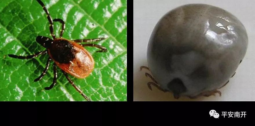 津城现疑似蜱虫叮咬病例？专家来解读！「平安警务室」