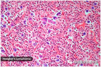 盗汗的原因男士,小孩盗汗什么原因