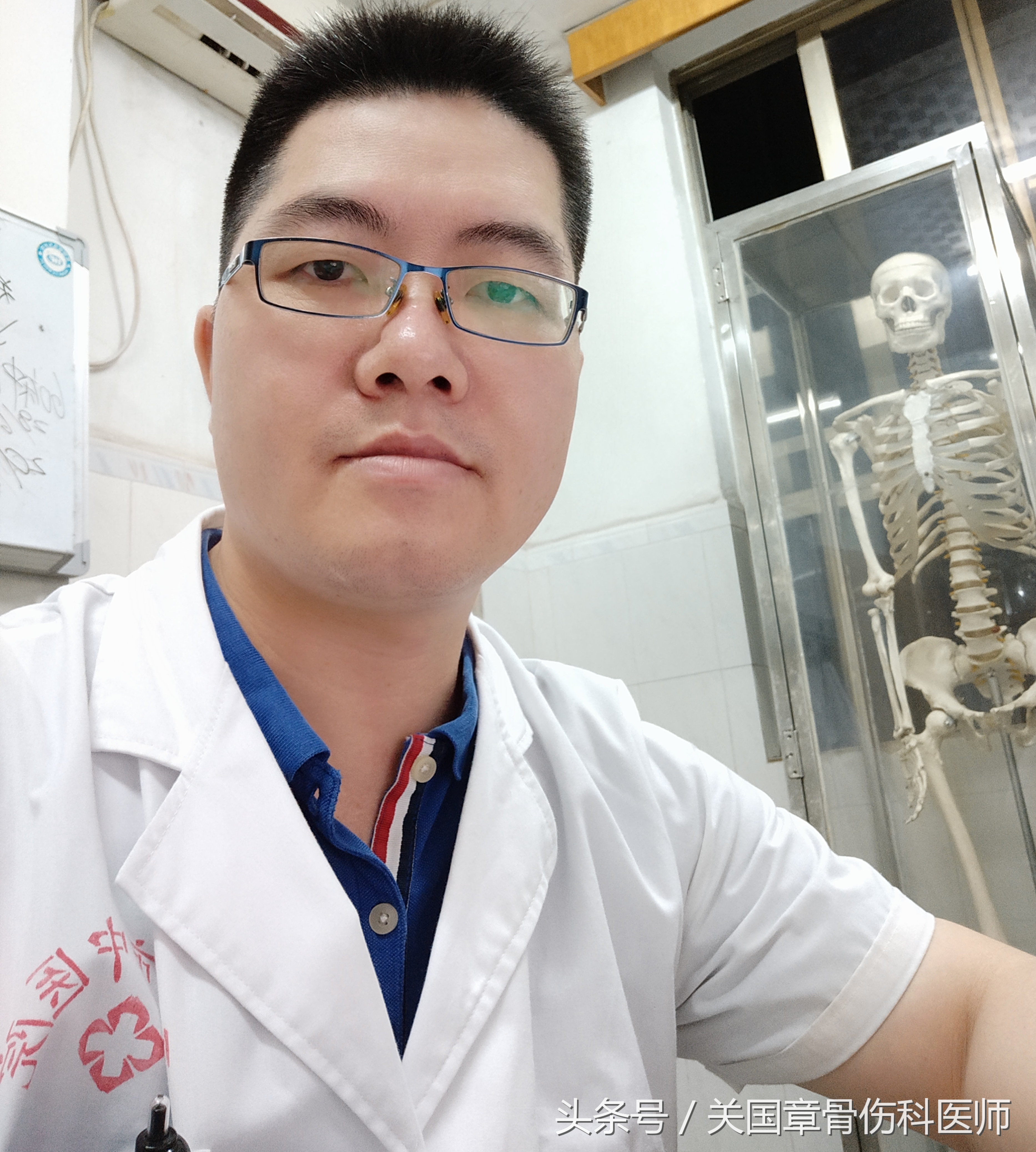 维生素e怎么用祛斑祛痘印,维生素e可以祛斑祛痘吗