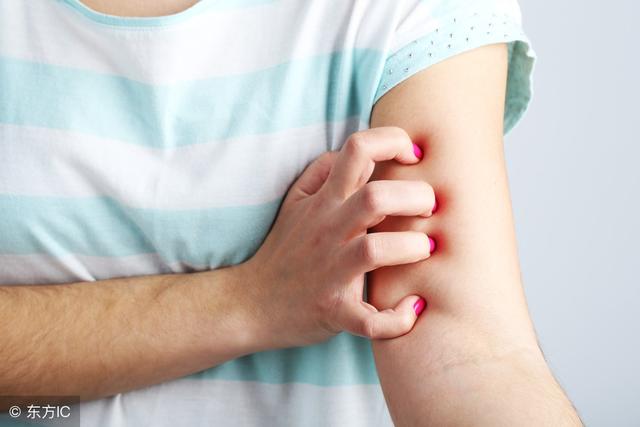 十种湿疹不能治好,湿疹最怕三种花