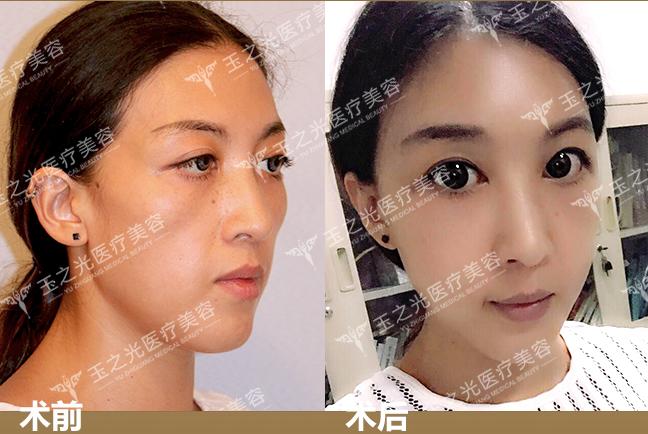 迪丽热巴现身发布会现场，发生了什么？「整形医生王明利」