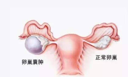怎么预防荷兰猪囊肿复发,荷兰猪的囊肿怎么在家自行处理
