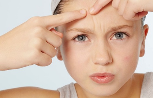 油痘肌祛痘最好的精华,适合任何痘的祛痘药膏有哪些