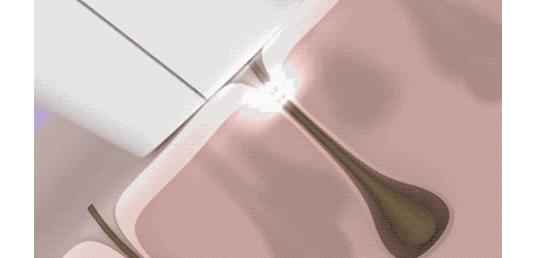 要想穿得少，脱毛要趁早！我用10款脱毛产品薅光了男同事的腿毛