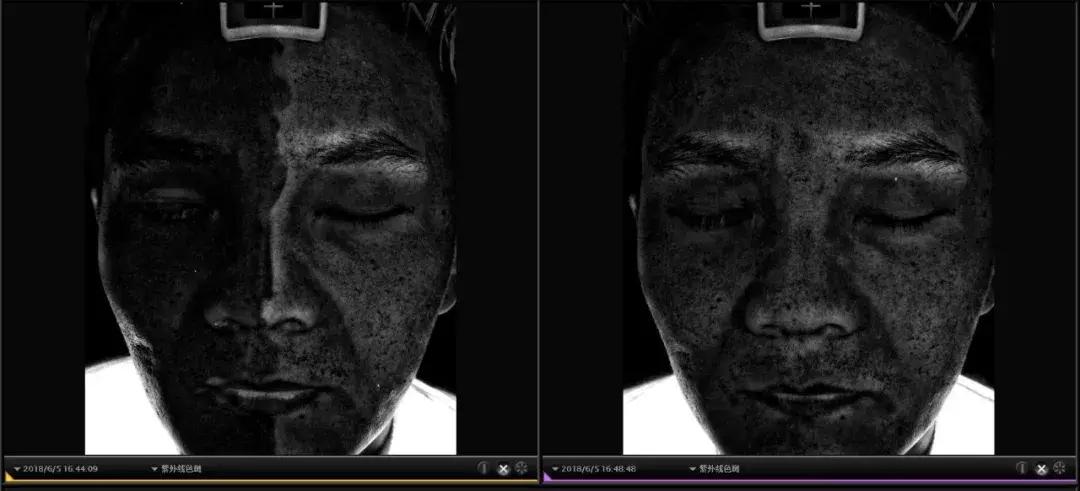 你以为防晒只擦防晒霜就够了吗,以为很好用其实都是智商税防晒霜