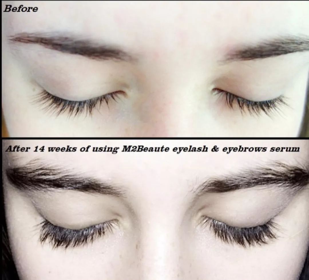 刘嘉玲代言的痘痘修复面霜,刘嘉玲紧致面霜