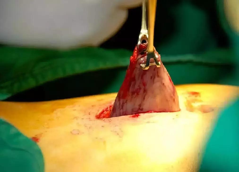 催吐,外挂般的减肥方式?吃的是欲望,吐的是灵魂