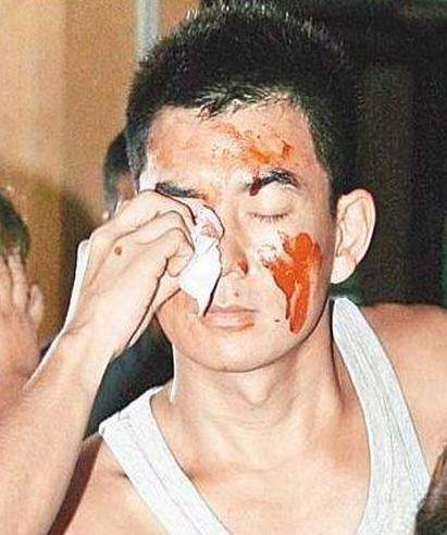 因拍戏受伤的十大明星,因拍戏而受伤的十大明星