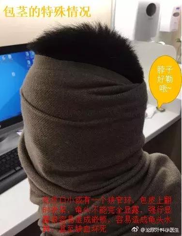 怎么判断自己的包皮需不需要割,如何判断包皮到底需不需要割