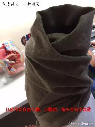 什么样的包皮一定割掉,包皮手术40几岁还能做吗