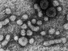 乙肝大小三阳表现症状有哪些,大三阳小三阳是肝炎么