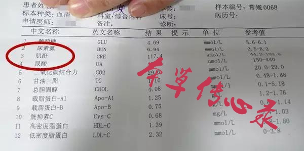 轻松看懂尿液检查化验单