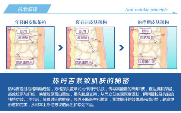 林允有没有鱼尾纹,林允法令纹