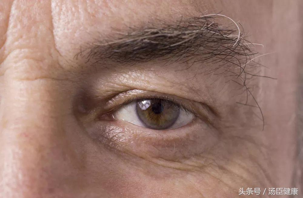 什么样的眉毛是杂乱眉,眉毛非常稀疏适合雾眉还是线条眉