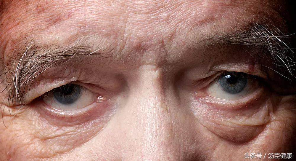 什么样的眉毛是杂乱眉,眉毛非常稀疏适合雾眉还是线条眉