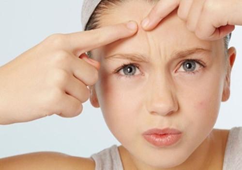 用盐水洗脸有助于减少痘痘吗,怎么有些人用冷水洗脸毛孔会粗大