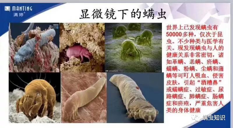 一换季就长痘怎么办,一换季就长痘痘还痒
