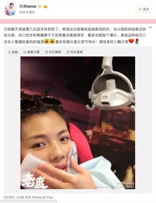 美容冠需要杀牙神经吗,美容冠是全瓷牙吗