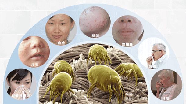 爱美的人，注意健康的人，不放过生活每个细节——螨虫