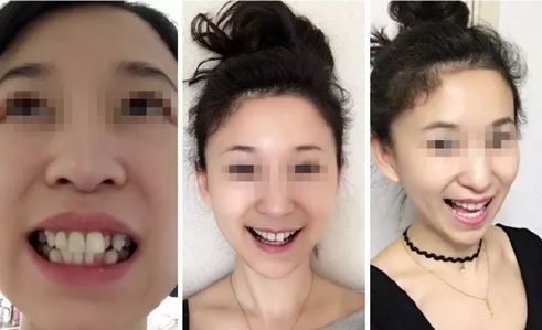 速看！刚刚发布大消息！8月起牙齿矫正、种植牙这10项费用全免！