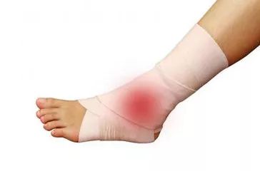 糖尿病足的皮肤,糖尿病足早期信号