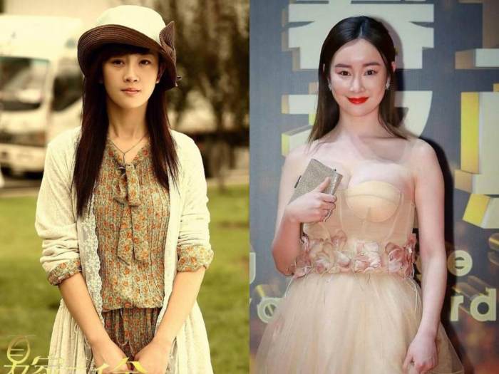 夏家三千金张檬有没有整容,整容女明星夏家三千金