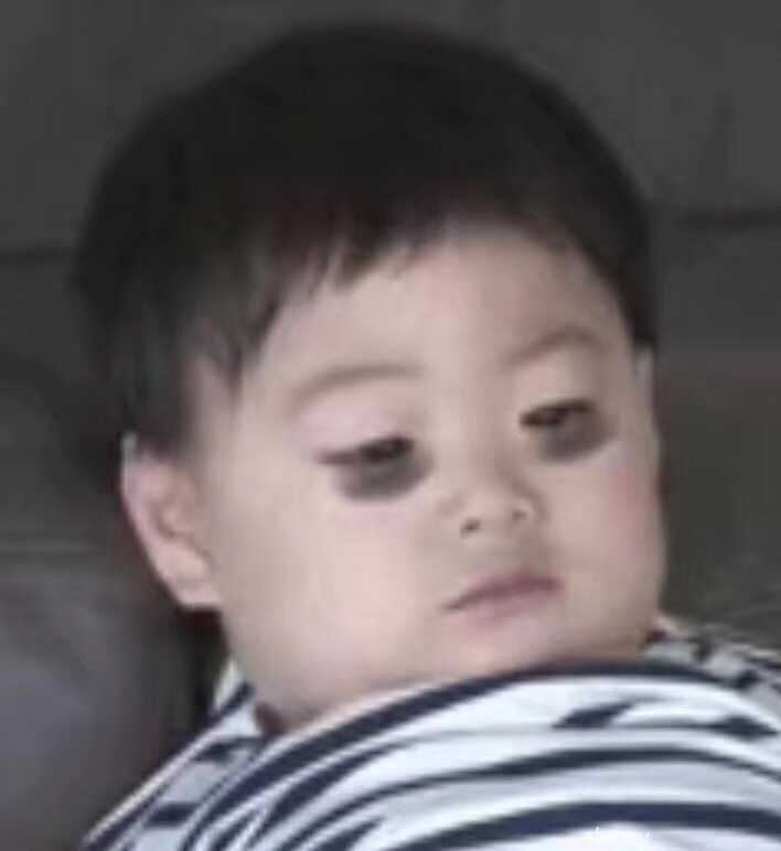 消除眼细纹眼霜,改善肿眼的眼霜