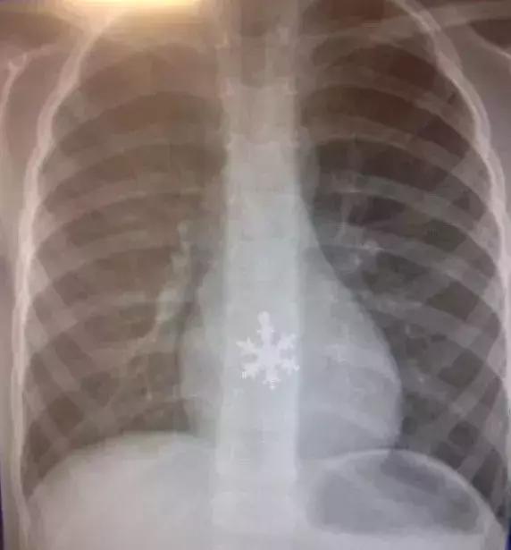 这些奇葩的X光片，看得整个人有点不自在！