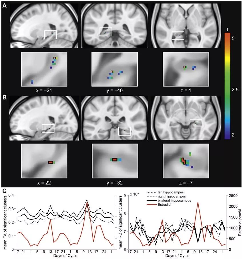月经会改变日期吗,月经和大脑有没有关联