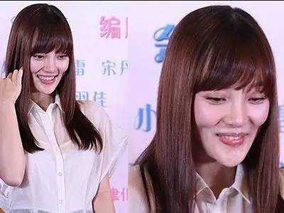 有人劝你打玻尿酸,打玻尿酸的一些常识问题