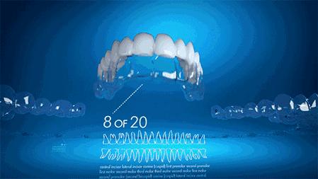 牙齿矫正8月最新价格,2024年30岁牙齿矫正费用多少钱