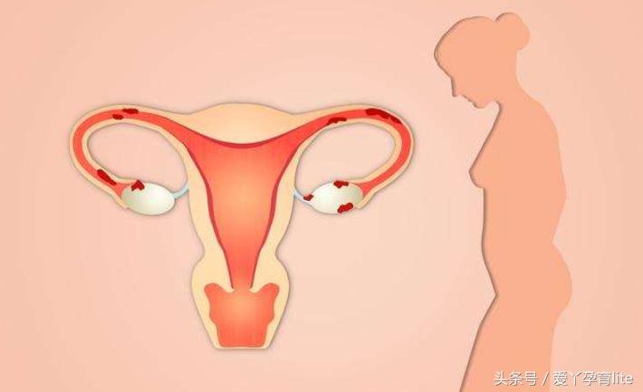 关于计算排卵期最全的视频,排卵期测算视频