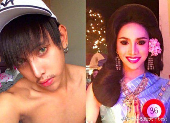 泰国人变性术前后对比,泰国的变性手术是什么原理