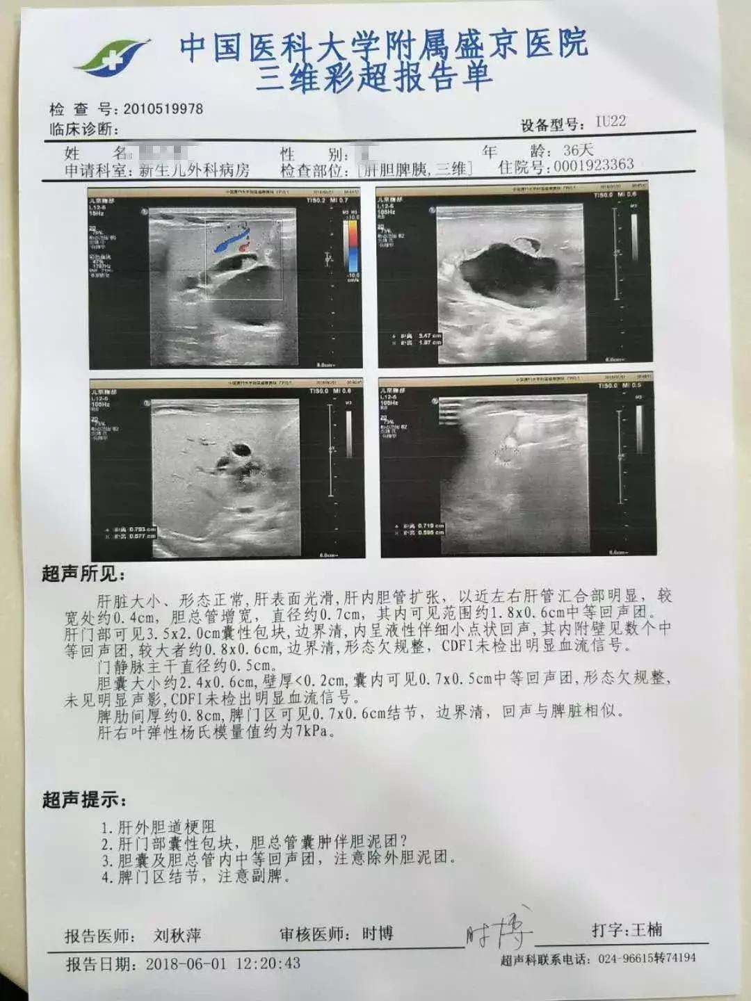 新生儿先天性肠闭锁要多少手术费,婴儿先天性心脏病手术费能报销吗