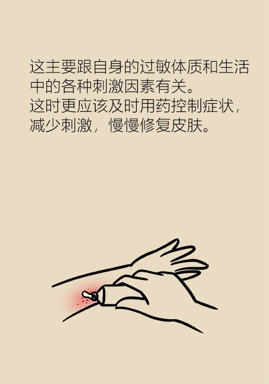 湿疹反复去医院挂哪个科,湿疹看西医反反复复怎么办