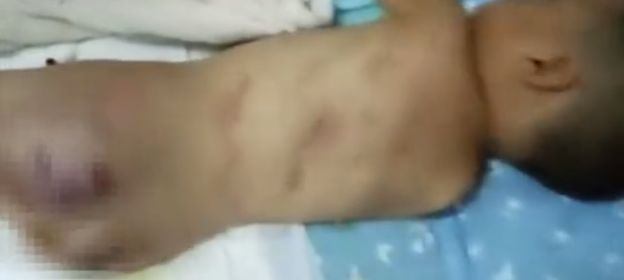 惨不忍睹！嘴巴里灌开水、眼眶周围都是血……男童走失被邻村人虐待