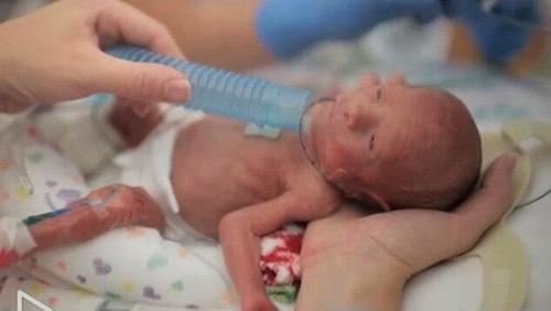 早产宝宝如何护理新手爸妈必看,先兆早产的护理问题及护理措施