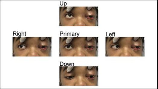 牙疼喉咙疼耳朵疼颈椎疼,小姐姐眼睛疼