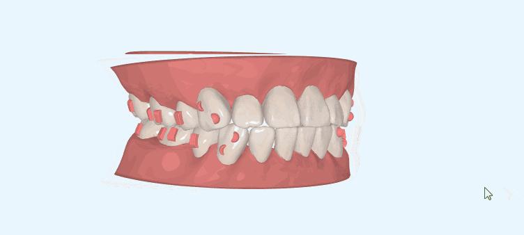 超实用的拔牙小技巧有哪些,拔牙知识图片