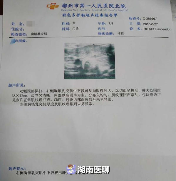 一岁宝宝胸骨突出,1岁宝宝一边肋骨突出是怎么回事