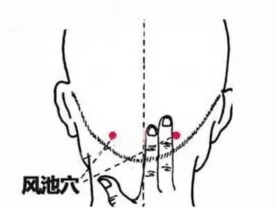 艾慈灸治疗咳嗽,怎么温灸治疗咳嗽