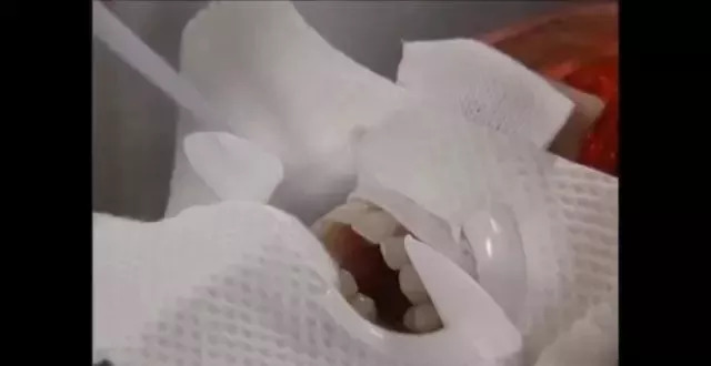 蓝光美白牙仪真的管用吗,美牙仪冷光美白原理