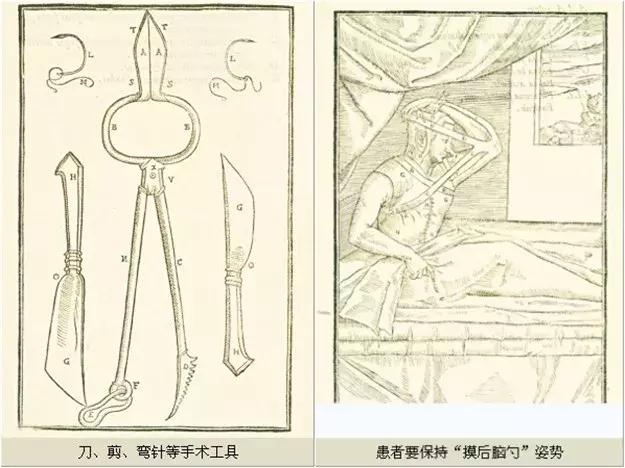 现代易容术整容技术,易容术复原面部缺陷