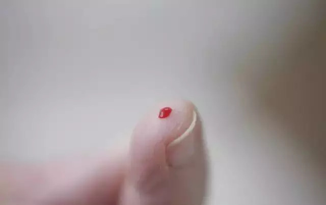 孩子碰伤怎么快速止血,小孩被外力碰伤淤青怎样快速消除