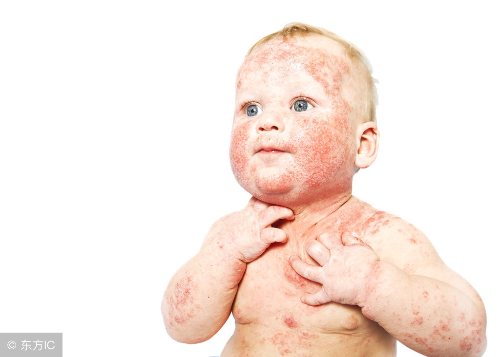 立秋后，宝宝瘙痒难耐，不要慌，此草煮水抹身上，消除湿疹不反复