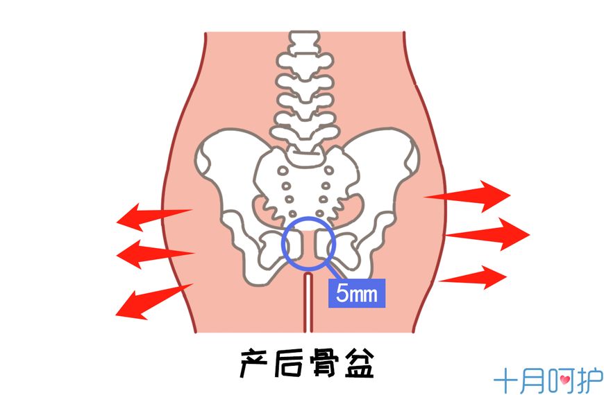 生了孩子怎么改善胯宽,生过孩子胯宽屁股大怎么办