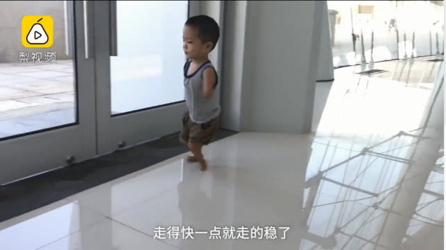 海豹畸形婴儿长大,海豹畸形宝宝